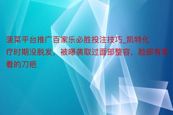 菠菜平台推广百家乐必胜投注技巧_凯特化疗时期没脱发，被曝袭取过面部整容，脸部有彰着的刀疤